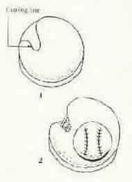 Baseball Mitt Cake Diagram